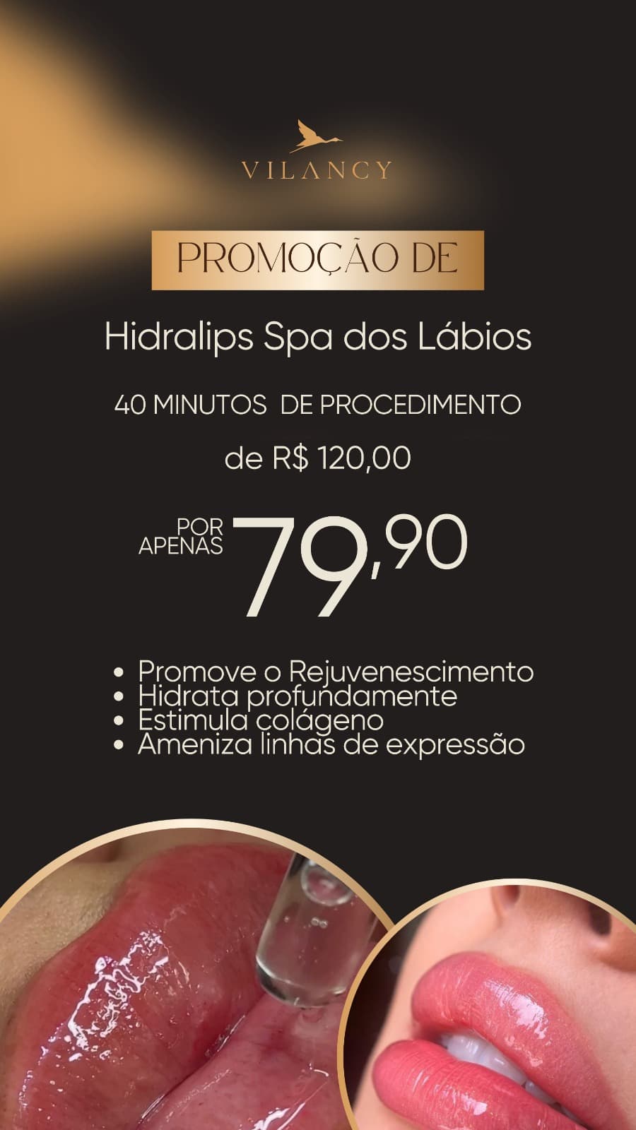 HIDRALIPS - SPA LABIAL